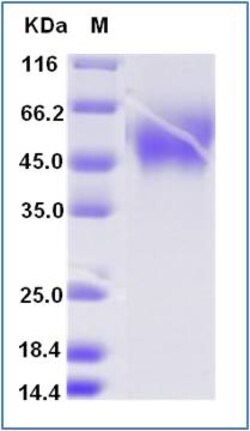 Sino Biological Recombinant Human B7-H4 Protein (ECD, His & AVI Tag), Biotinylated,