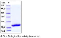 Sino Biological Recombinant Human CD42c Protein (His Tag), Quantity: Each
