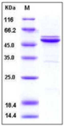 Sino Biological Recombinant Human JNK2 Protein (His Tag), Quantity: Each