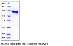 Sino Biological Recombinant Human P38 Delta/MAPK13 Protein (GST Tag), Activated