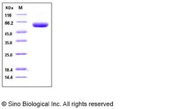 Sino Biological Recombinant Cynomolgus, Rhesus CCK4/PTK7 Protein (His Tag),