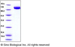 Sino Biological Recombinant Human MICB Protein (His & hFc Tag), Quantity: