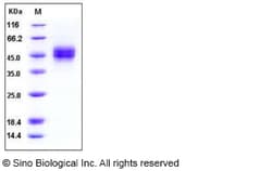 Sino Biological Recombinant Human MICB Protein (His Tag), HPLC-verified,