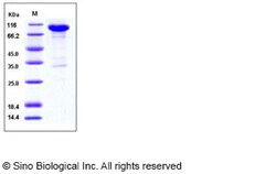 Sino Biological Recombinant Human EphB2 Protein (His & hFc Tag), Quantity: