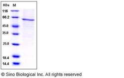 Sino Biological Recombinant Human AKT1 Protein (His Tag), HPLC-verified,
