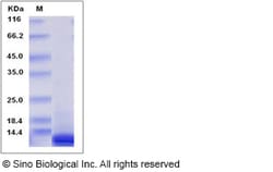 Sino Biological Recombinant Human IP-10/CXCL10 Protein, Quantity: Each