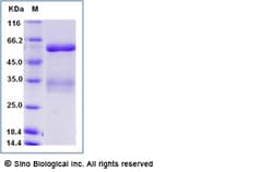 Sino Biological Recombinant Human ANGPTL3/Angiopoietin-like 3 Protein (His