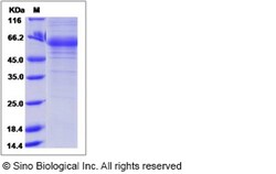 Sino Biological Recombinant Human Adiponectin Protein (hFc Tag), Quantity:
