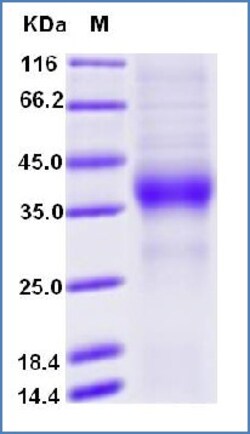 Sino Biological Human ASGPR1 / ASGR1 Protein (His Tag), Biotinylated 20ug,