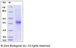 Sino Biological Recombinant Human ASGR1 Protein (His Tag), HPLC-verified,