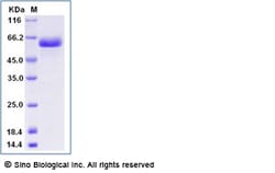 Sino Biological Recombinant Human CD40/TNFRSF5 Protein (ECD, hFc Tag),