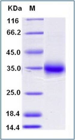 Sino Biological Recombinant Human CD40/TNFRSF5 Protein (ECD, His & AVI