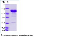 Sino Biological Recombinant Human CD40/TNFRSF5 Protein (ECD, mFc Tag),
