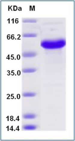 Sino Biological Recombinant Human CD40/TNFRSF5 Protein (ECD, hFc & AVI