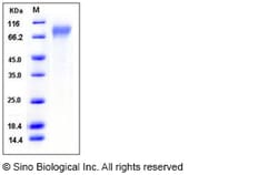 Sino Biological Human CD30 / TNFRSF8 Protein (His Tag) 100ug, Quantity:
