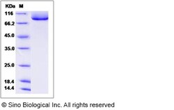 Sino Biological Human TGFBR3 / Betaglycan Protein (His Tag) 100ug, Quantity:
