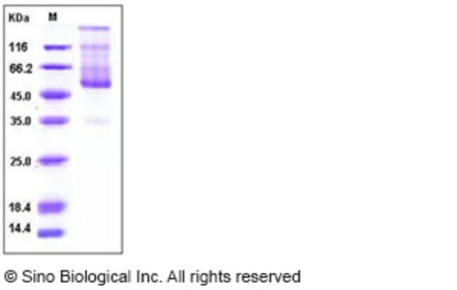 Sino Biological Human CD70 / CD27L / TNFSF7 Protein (Fc Tag) 1mg ...