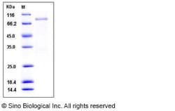 Sino Biological Recombinant Human BLK Protein (GST Tag), Quantity: Each