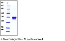 Sino Biological Human ASAM / CLMP Protein (His Tag) 100ug, Quantity: Each