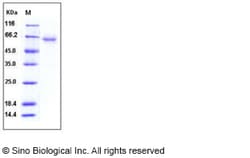 Sino Biological Recombinant Human CXADR/CAR Protein (His & hFc Tag), Quantity: