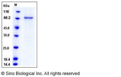 Sino Biological Recombinant Human MAP3K8 Protein (GST Tag), Quantity: Each