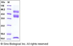 Sino Biological Human Latent TGF-beta 1 / TGFB1 Protein (His Tag), Biotinylated