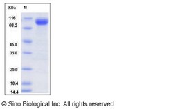 Sino Biological Recombinant Human CD10/Neprilysin Protein (His Tag), Quantity: