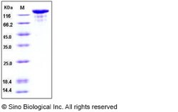 Sino Biological Recombinant Human VEGFR3/FLT4 Protein (ECD, hFc Tag), HPLC-verified,