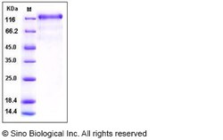 Sino Biological Recombinant Human VEGFR3/FLT4 Protein (His Tag), HPLC-verified,