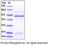 Sino Biological Human Inhibin beta B / INHBB / Activin B Protein (His Tag)