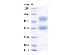Sino Biological SARS-CoV-2 (2019-nCoV) Spike S1 (L18F, T20N, P26S, D138Y,