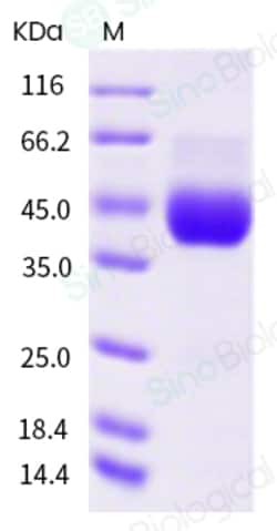 Sino Biological Recombinant Human CD38 Protein (ECD, His Tag), HPLC-verified,