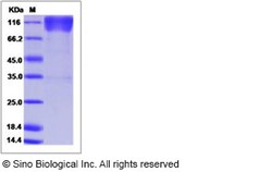 Sino Biological Recombinant Human CEACAM-1/CD66a Protein (ECD, His & hFc