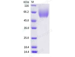 Sino Biological Recombinant Human CEACAM-1/CD66a Protein (ECD, His Tag),