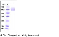 Sino Biological Human CEACAM1 / CD66a Protein (ECD, His Tag) 100ug, Quantity: