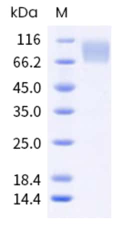 Sino Biological Human CEACAM6 Protein 1MG (Sino Biological), Quantity: