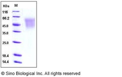 Sino Biological Recombinant Human CEACAM-6/CD66c Protein (His Tag), HPLC-verified,