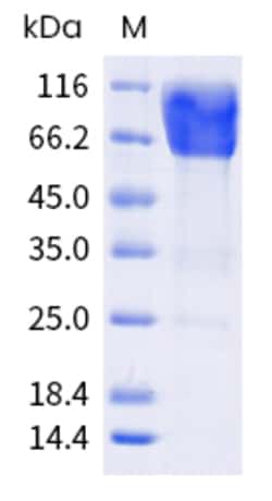 Sino Biological Human CEACAM6 Protein 100ug (Sino Biological), Quantity: