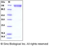 Sino Biological Recombinant Human FGFR2 Protein (His & hFc Tag), HPLC-verified,