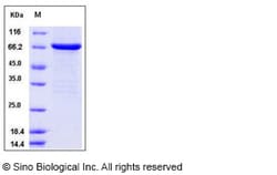 Sino Biological Recombinant Human FGFR2 Protein (aa 400-821, His & GST