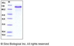 Sino Biological Recombinant Human Progranulin Protein (His Tag), Quantity: