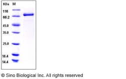 Sino Biological Recombinant Human Lyn Protein (GST Tag), Quantity: Each