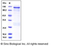 Sino Biological Recombinant Human RSK3 Protein (GST Tag), Quantity: Each