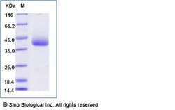 Sino Biological Recombinant Human CXCL16 Protein (His Tag) 500 µg, Quantity: