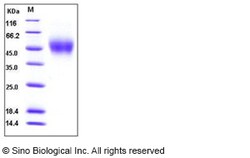 Sino Biological Recombinant Human SLAM/CD150 Protein (His Tag), HPLC-verified,