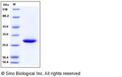 Sino Biological Human 14-3-3 sigma / Stratifin / YWHAS Protein 100ug, Quantity: