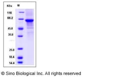 Sino Biological Recombinant Human DKKL1 Protein (hFc Tag), Quantity: Each