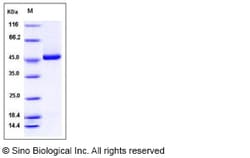 Sino Biological Recombinant Human kynureninase/KYNU Protein (His Tag),