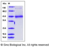 Sino Biological Recombinant Human MFGE8 Protein (His Tag), Quantity: Each