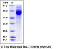 Sino Biological Recombinant Human GPR114 Protein (hFc Tag), Quantity: Each